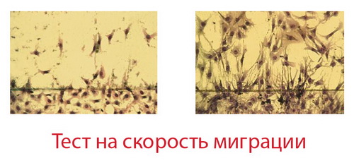 Milk peptide complex 1 Milk peptide complex 1
