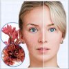 Rhodofiltrat Palmaria (������������ ���������) - ��������� �������� � ���������