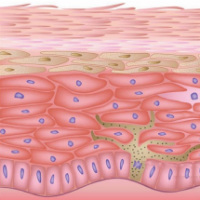 Ceramide III (������� III, Ceramide NP), ������� �������