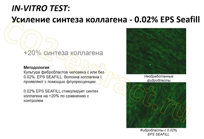 eps