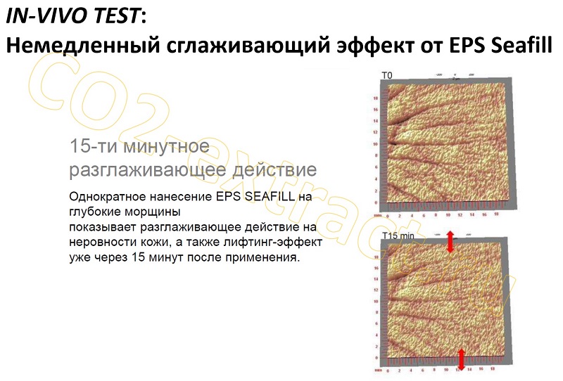 eps