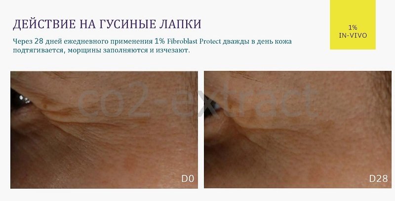 fibroblast protect