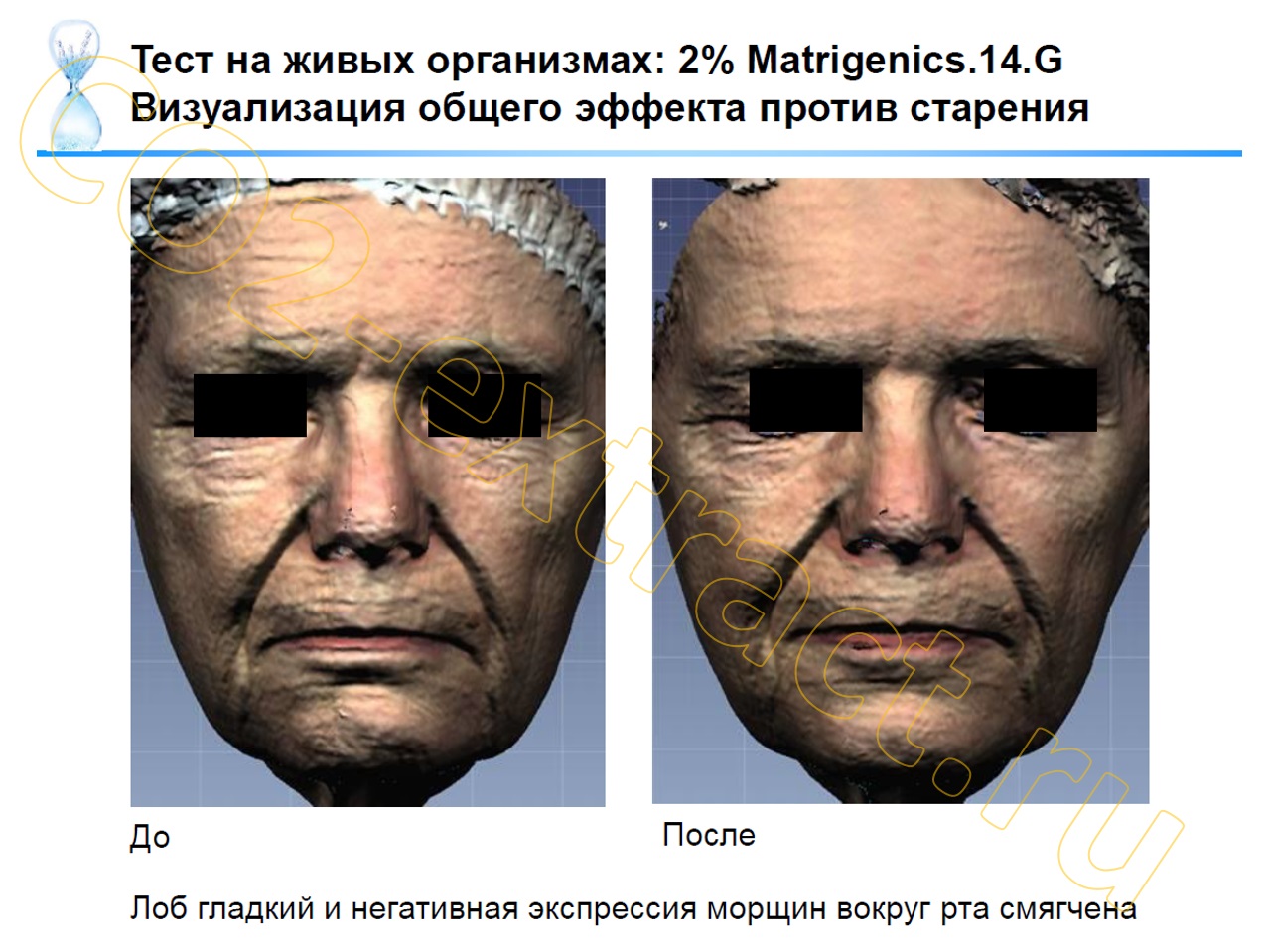 matrigenics