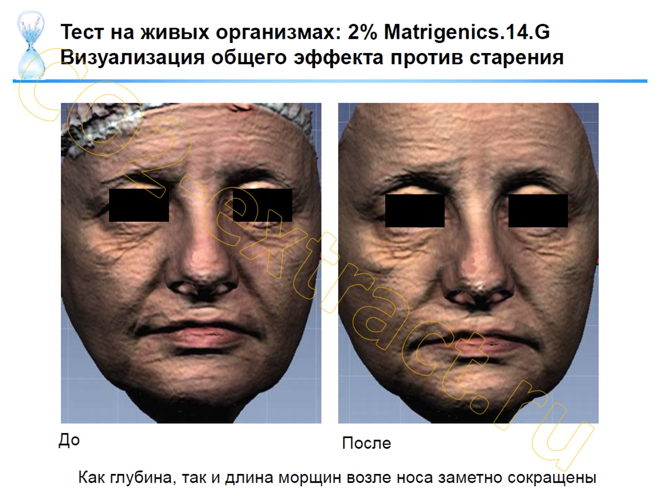 matrigenics