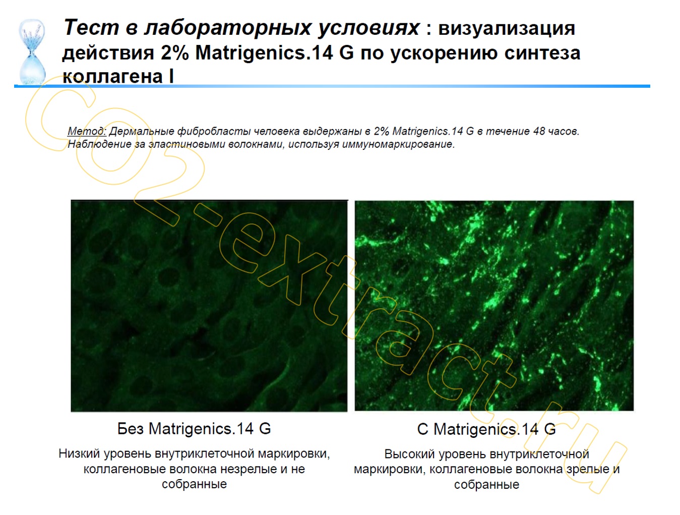 matrigenics