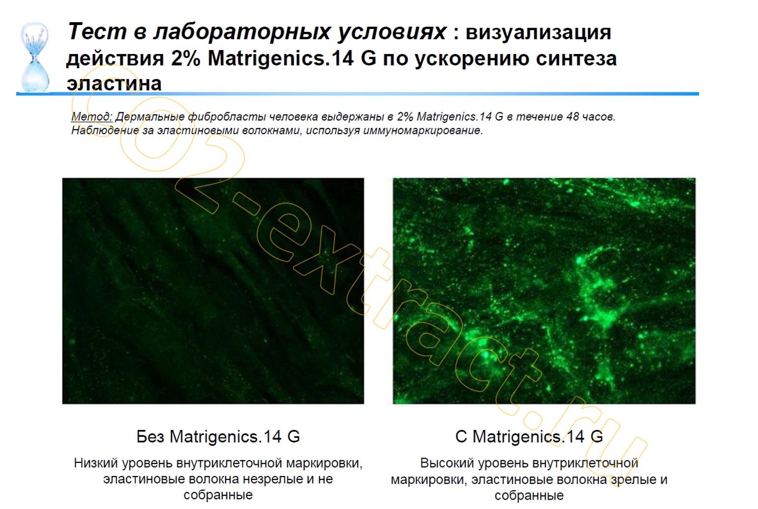 matrigenics