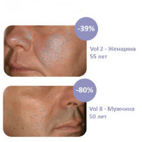 Минимайзер пор на основе Biochanin A Минимайзер пор на основе Biochanin A