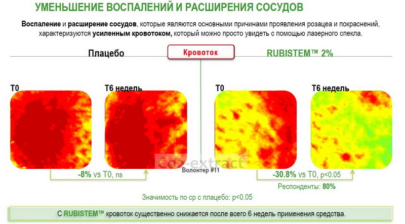 Rubistem ��������