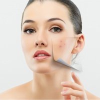 ����������� ������� (Azelaic acid)
