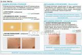 Resistem� (��������) - ��������� ������ ����������